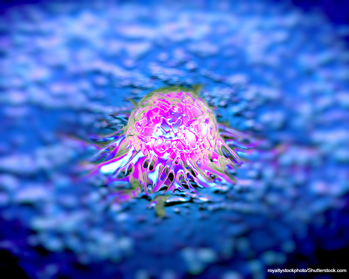 prostate cancer cell